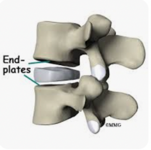 end-plates endplates